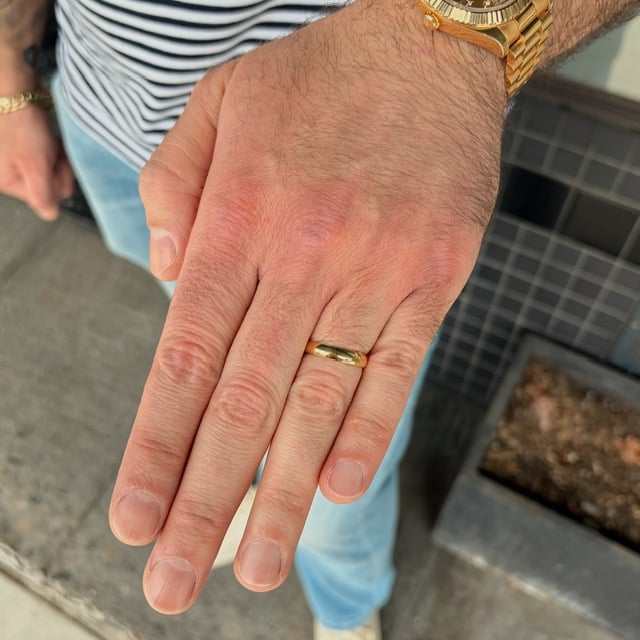 Left hand with a gold wedding band and gold watch, seen against a striped shirt and outdoors setting.